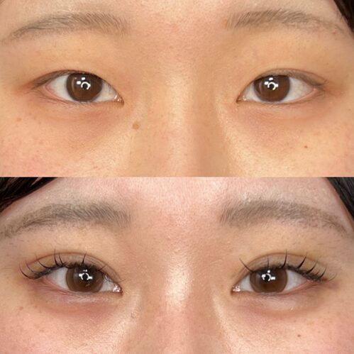 術前術後 比較画像