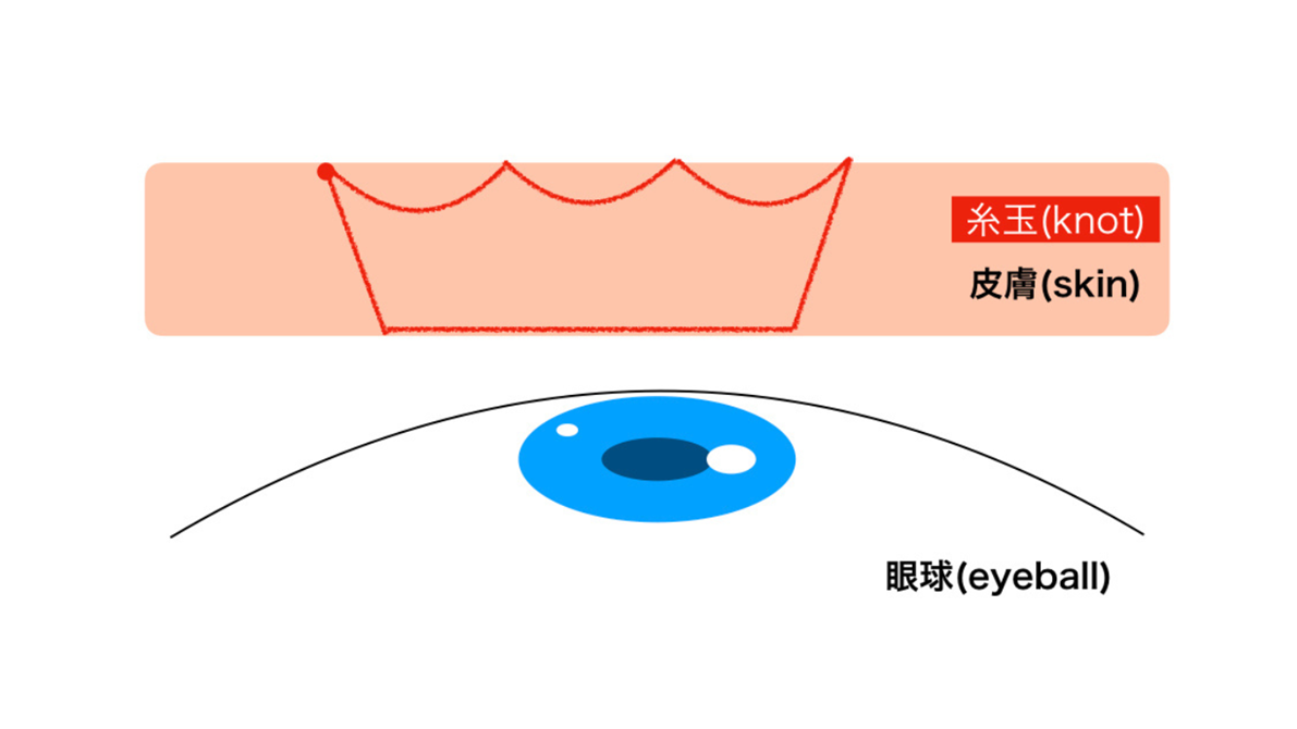 3点留めイラスト